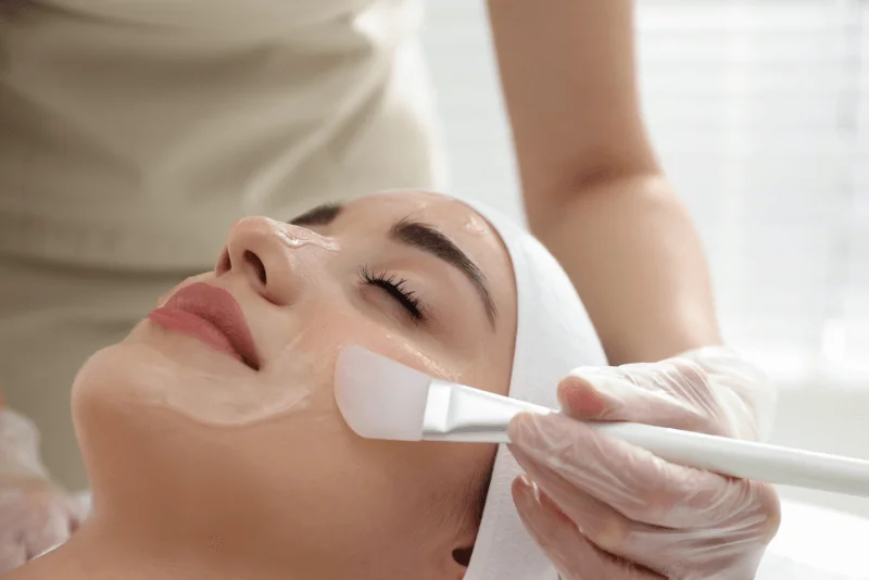 Chemical Peel in Phoenix Medical Spa