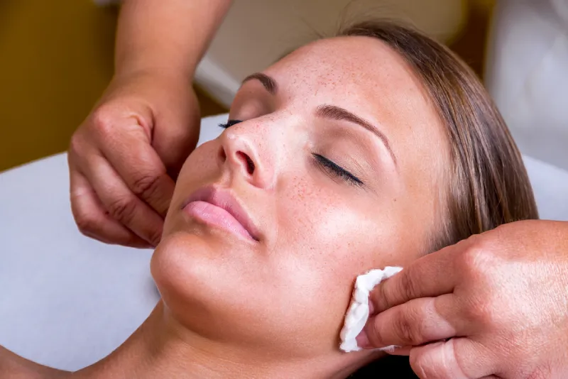 Chemical Peel in Phoenix Medical Spa