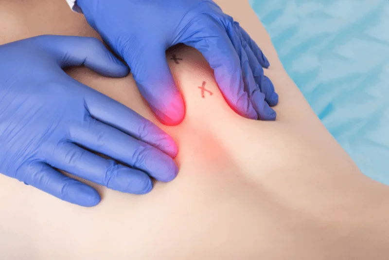 Trigger Point Therapy in Phoenix Medical Spa