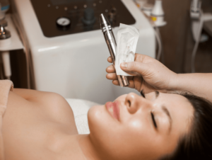 microneedling in best med spa of Phoenix