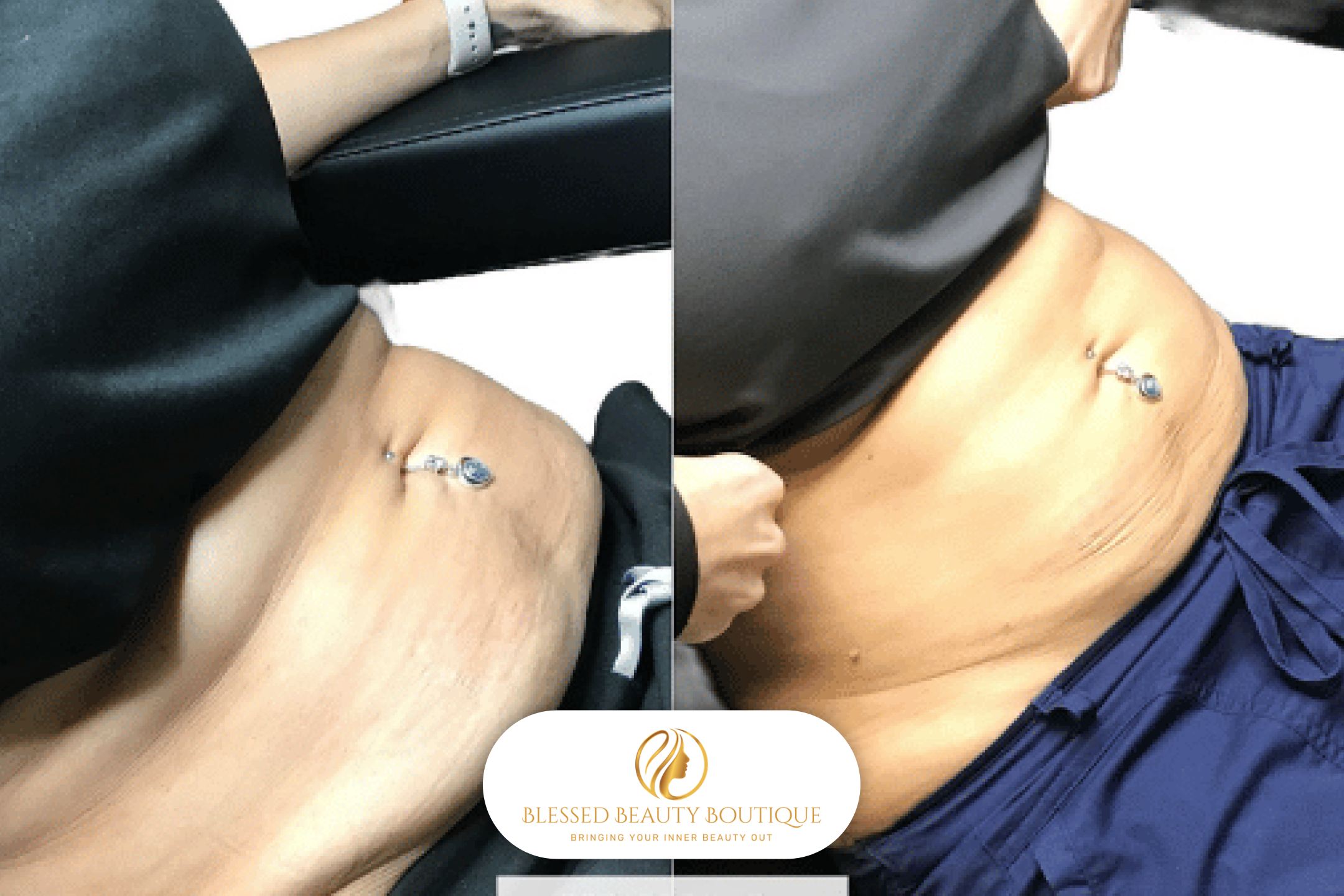 B&A Liquid Lipo 3