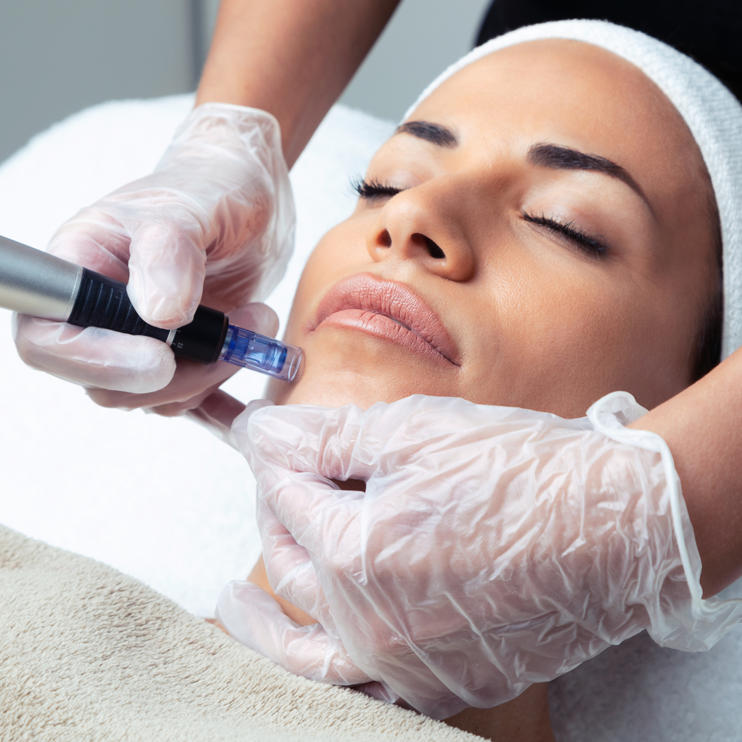 Microneedle Stem Cell Facial Phoenix AZ | Stem Cell Facial Microneedling Near Me