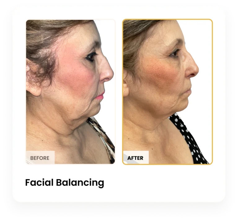 Treatment Card (2)