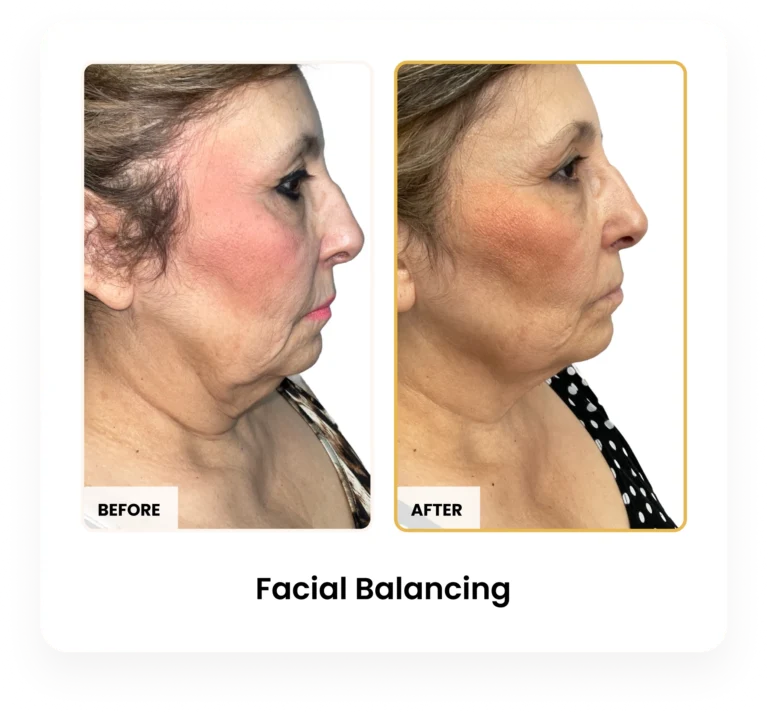 Facial Balancing before and after results at Blessed Beauty Boutique in Phoenix, Arizona