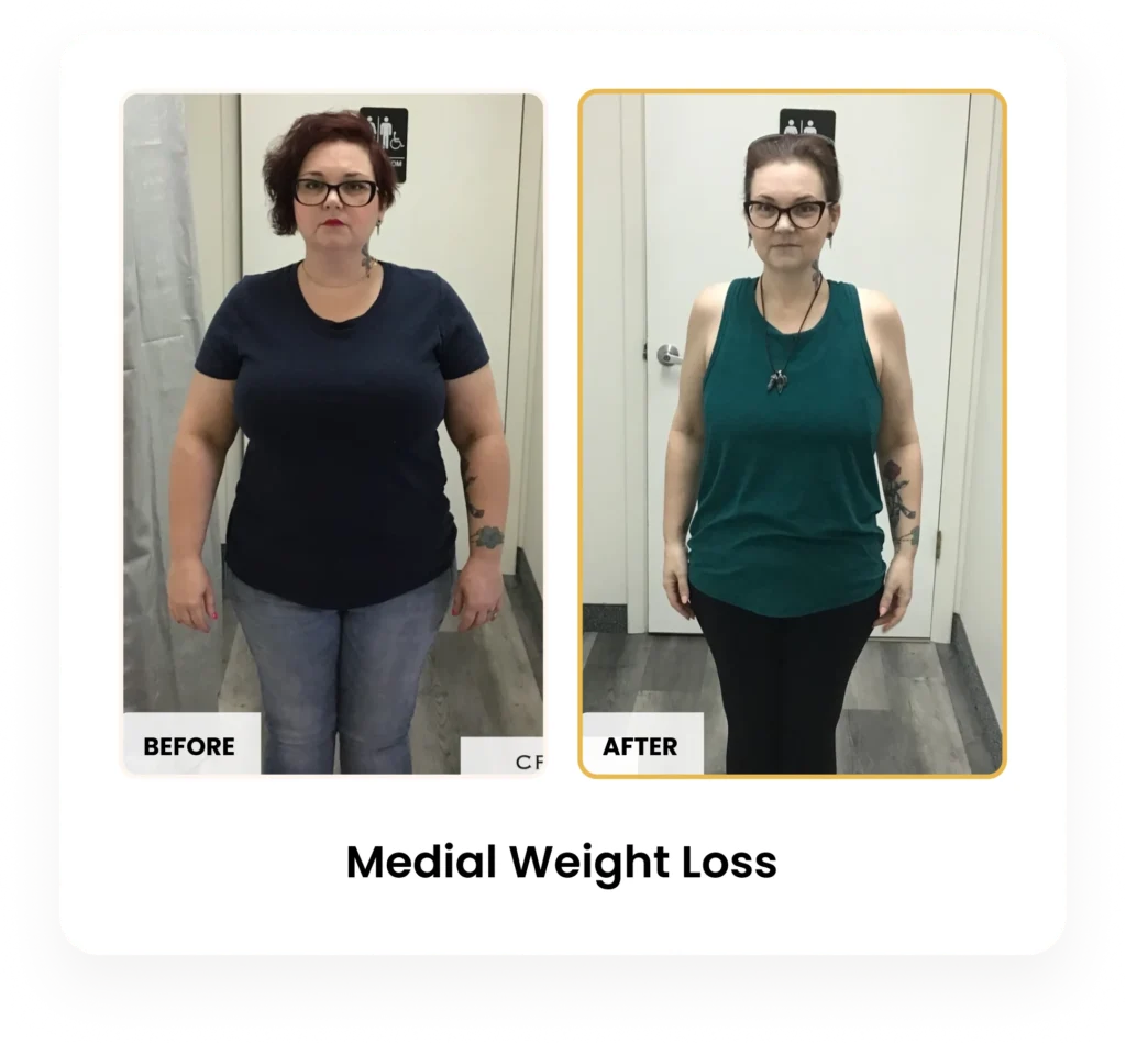 Medical Weight Loss before and after results at Blessed Beauty Boutique in Phoenix, Arizona