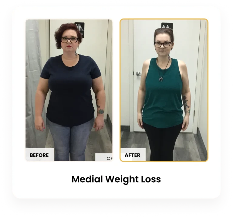 Medical Weight Loss before and after results at Blessed Beauty Boutique in Phoenix, Arizona