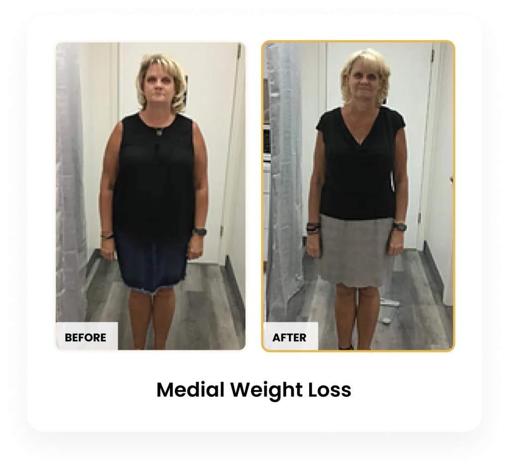 Medical Weight Loss before and after results at Blessed Beauty Boutique in Phoenix, Arizona