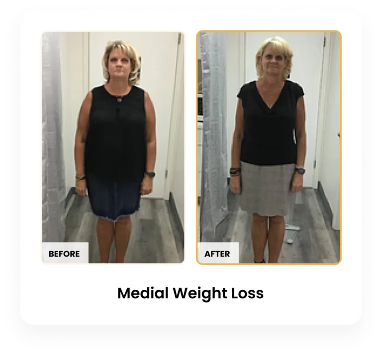 Medical Weight Loss before and after results at Blessed Beauty Boutique in Phoenix, Arizona
