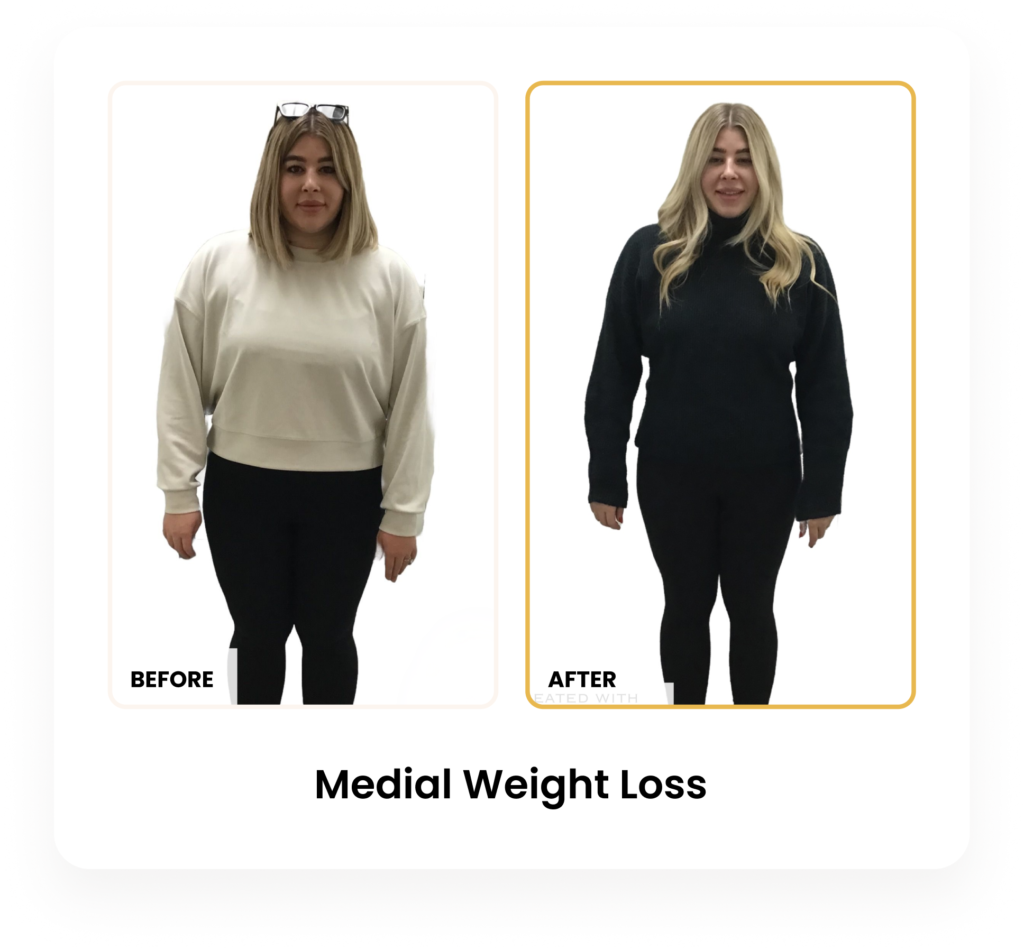 Medical Weight Loss before and after results at Blessed Beauty Boutique in Phoenix, Arizona