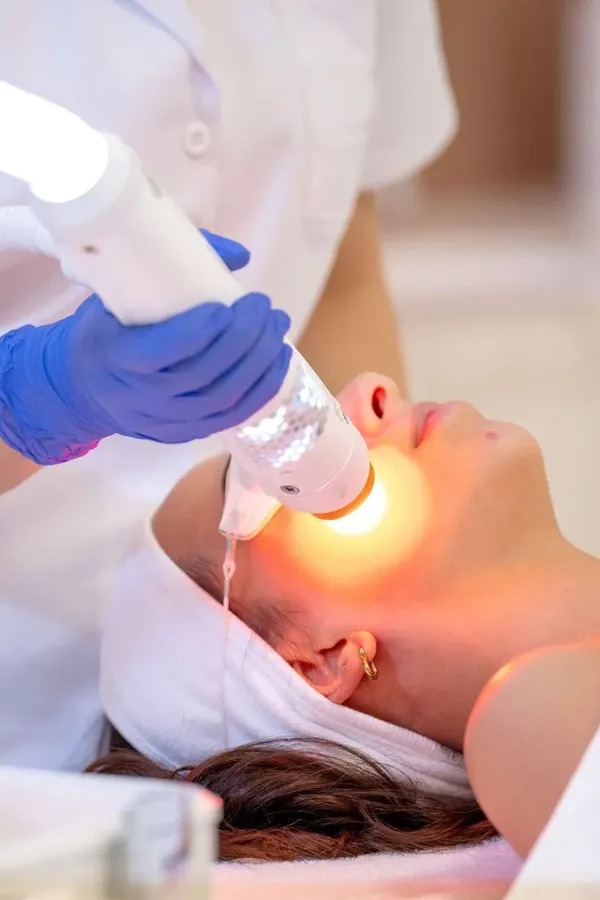 Aerolase-Neo-Laser-for-Skin-Treatment A woman receiving Aerolase Neo Laser treatment. Get Aerolase Neo Laser treatment from Blessed Beauty Boutique in Greater Phoenix.