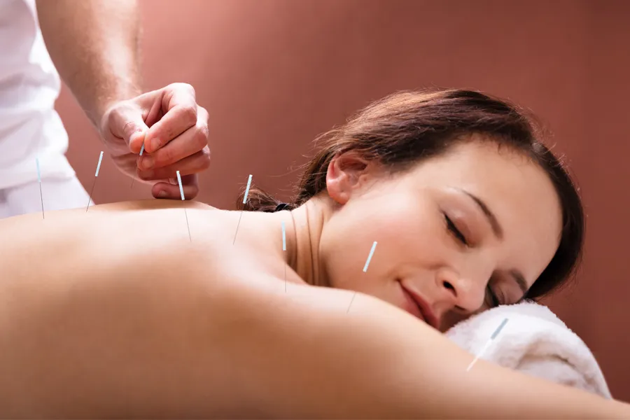 Dry-Needling-for-Pain-Relief-Clinic A woman lays on her stomach and gets dry needling treatment. Get Dry Needling for pain relief from Blessed Beauty Boutique in Greater Phoenix.