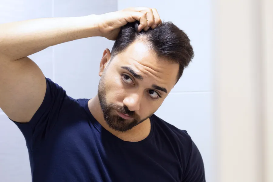 PRP-for-Hair-Loss-Doctor A man in a navy t-shirt looks in the mirror worrying about and touching his receding hairline, considering PRP for hair loss and restoration treatment from Blessed Beauty Boutique in Greater Phoenix.