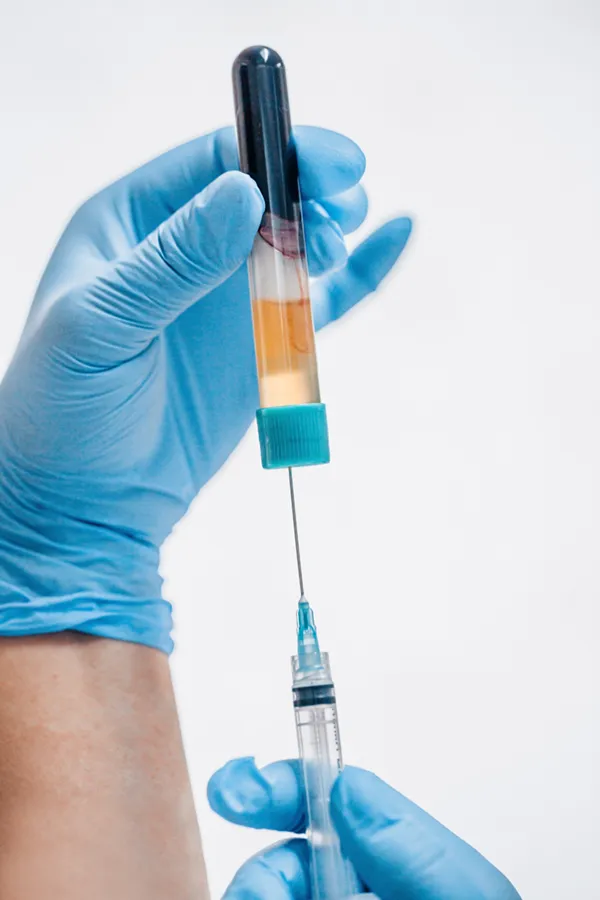 Phoenix-PRFM-Treatment Gloved hands processing a blood sample to create Selphyller Gel™ for natural volume restoration and skin rejuvenation. Schedule your SELPHYL® PRFM consultation with Blessed Beauty Boutique in Greater Phoenix.