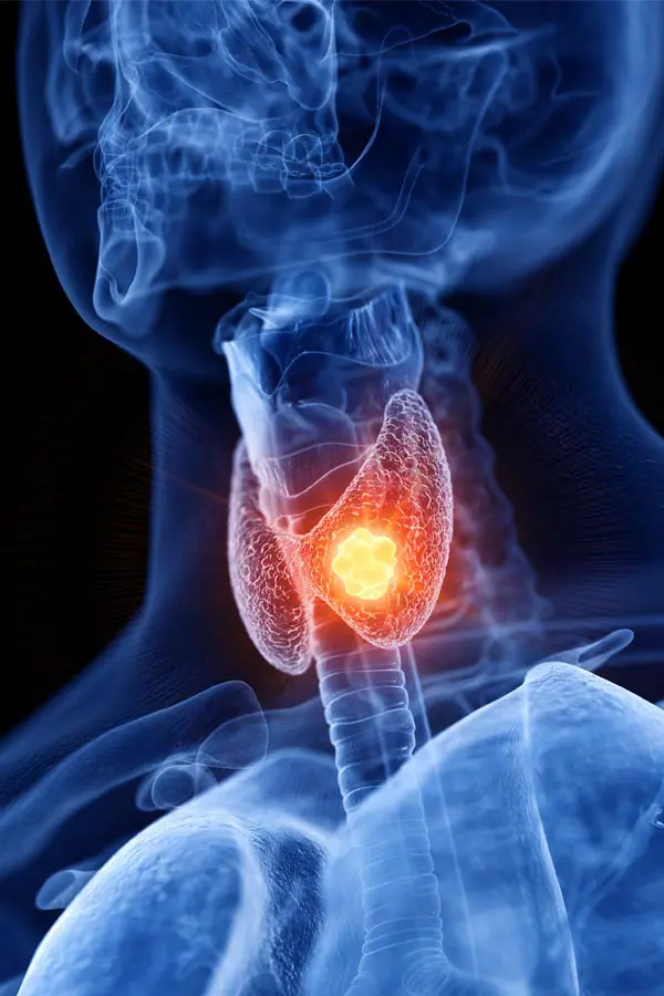 Thyroid-Imbalance-Treatment A 3D illustration of an x-ray of a human neck, highlighting the thyroid. Get help with thyroid imbalance from Blessed Beauty Boutique in Greater Phoenix.